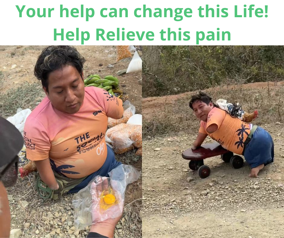Jonatan, 34 years old - Works crawling to not give up on life